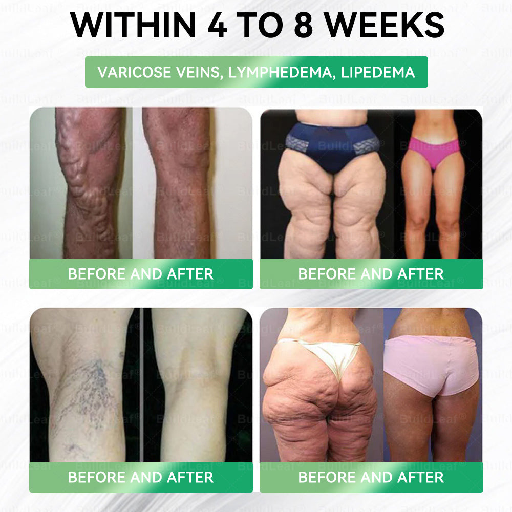 Official Store | BuildLeafยฎ GLP-1 8-in-1 Slim & Healthy Oral Solution (Once a day, results in 7 days), With 100 Billion CFU Active Probiotics โ
Supports weight management, heart health, diabetes, gut & womenโs health, while firming skin & boosting energy.