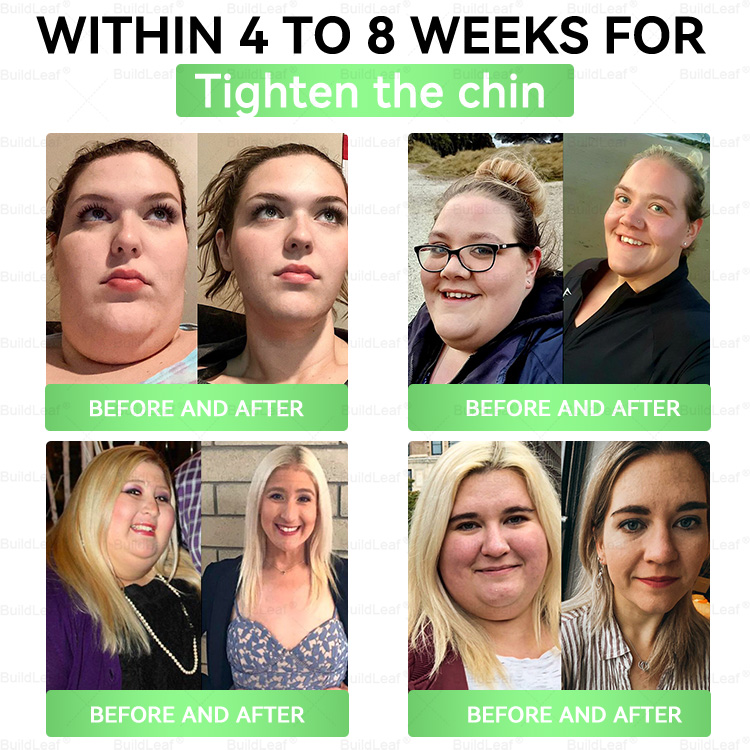 Official Store | BuildLeafยฎ GLP-1 8-in-1 Slim & Healthy Oral Solution (Once a day, results in 7 days), With 100 Billion CFU Active Probiotics โ
Supports weight management, heart health, diabetes, gut & womenโs health, while firming skin & boosting energy.