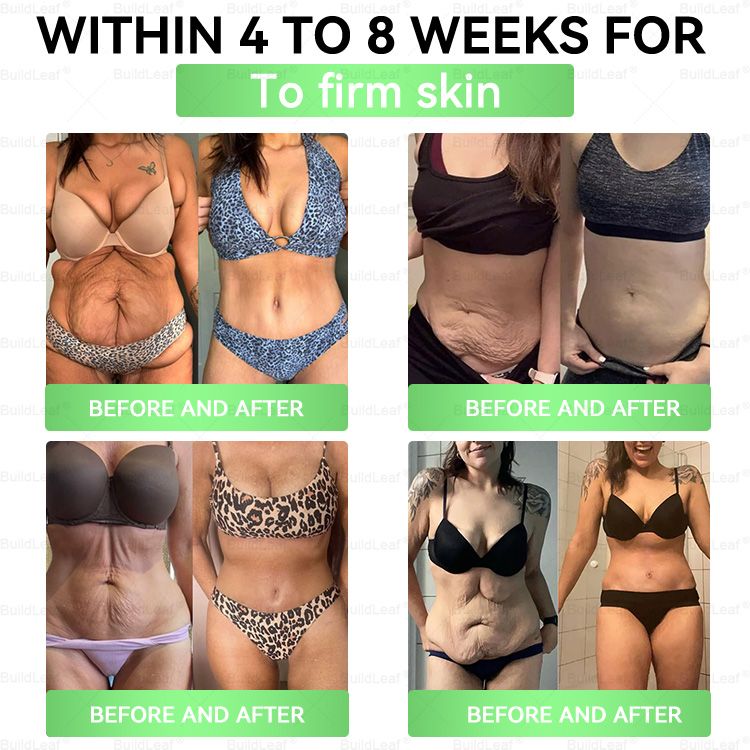 Official Store | BuildLeaf® GLP-1 8-in-1 Slim & Healthy Oral Solution (Once a day, results in 7 days), With 100 Billion CFU Active Probiotics ✅ Supports weight management, heart health, diabetes, gut & women’s health, while firming skin & boosting energy.